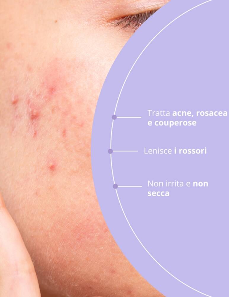 Freshly Cosmetics Azelaic Radiance Face Treatment