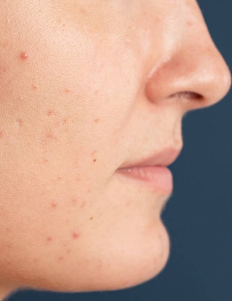 Freshly Cosmetics Blue Radiance Enzymatic Serum