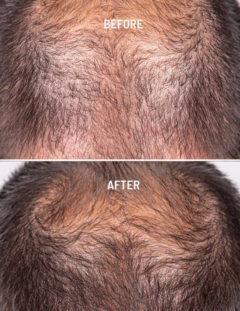 Freshly Cosmetics Hair Growth & Density Treatment