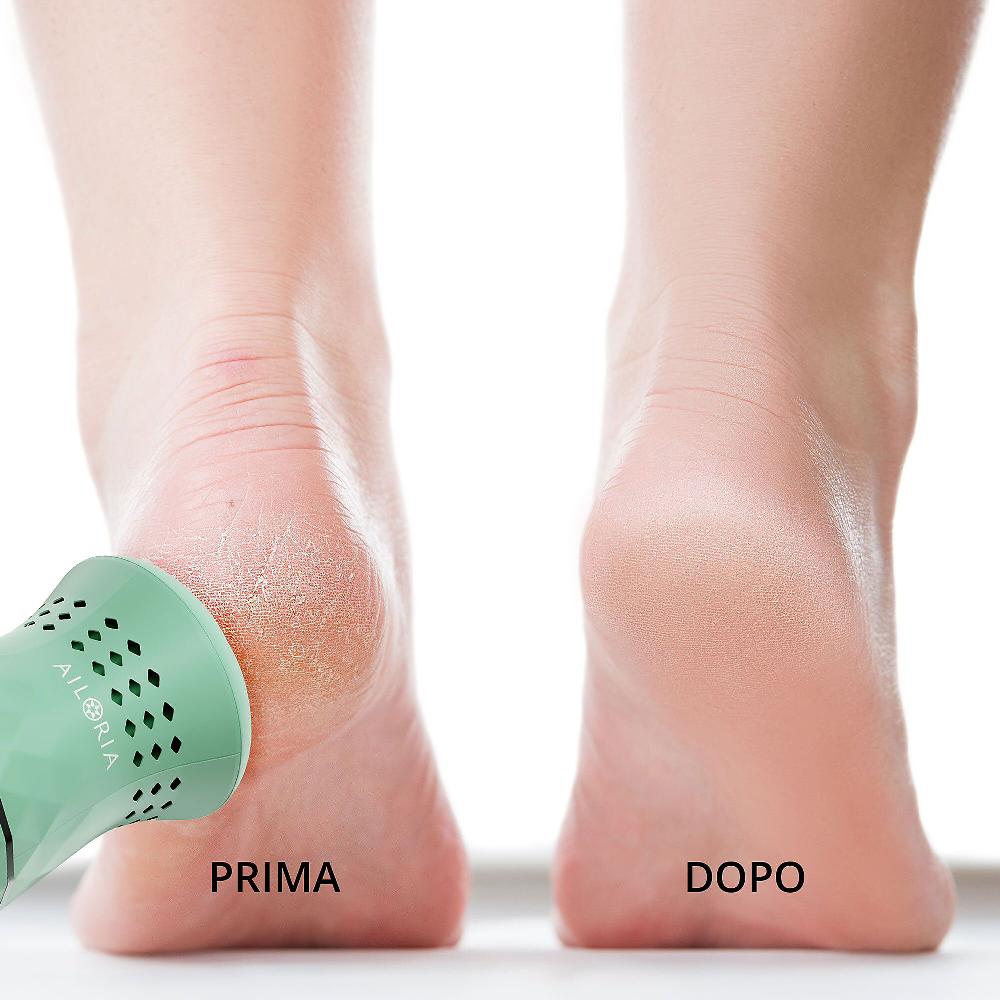 QVC AILORIA LUSTRE Levacalli Elettrico Funzione D Aspirazione