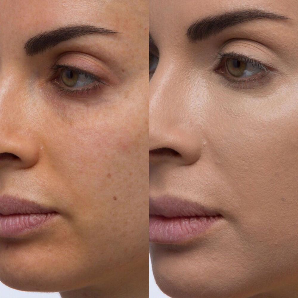 QVC Doll10 TCE Concealer 2 Correttori Con Spugnetta (3 Pz)