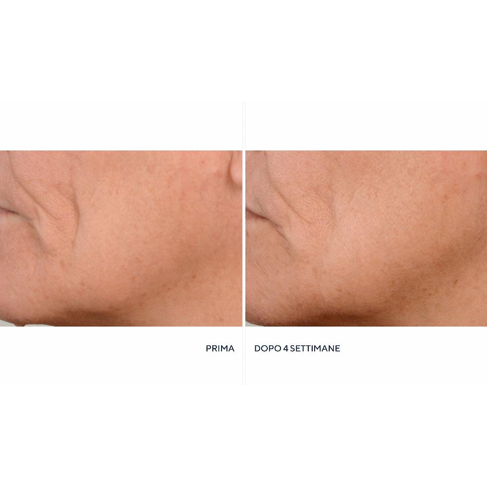 QVC Perricone MD 2 Idratanti Neuropeptide + Siero Firming & Lifting