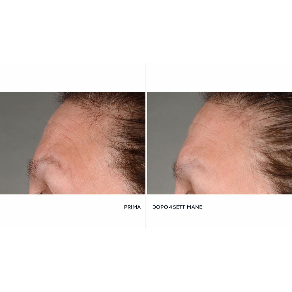 QVC Perricone MD 2 Idratanti Neuropeptide + Siero Firming & Lifting