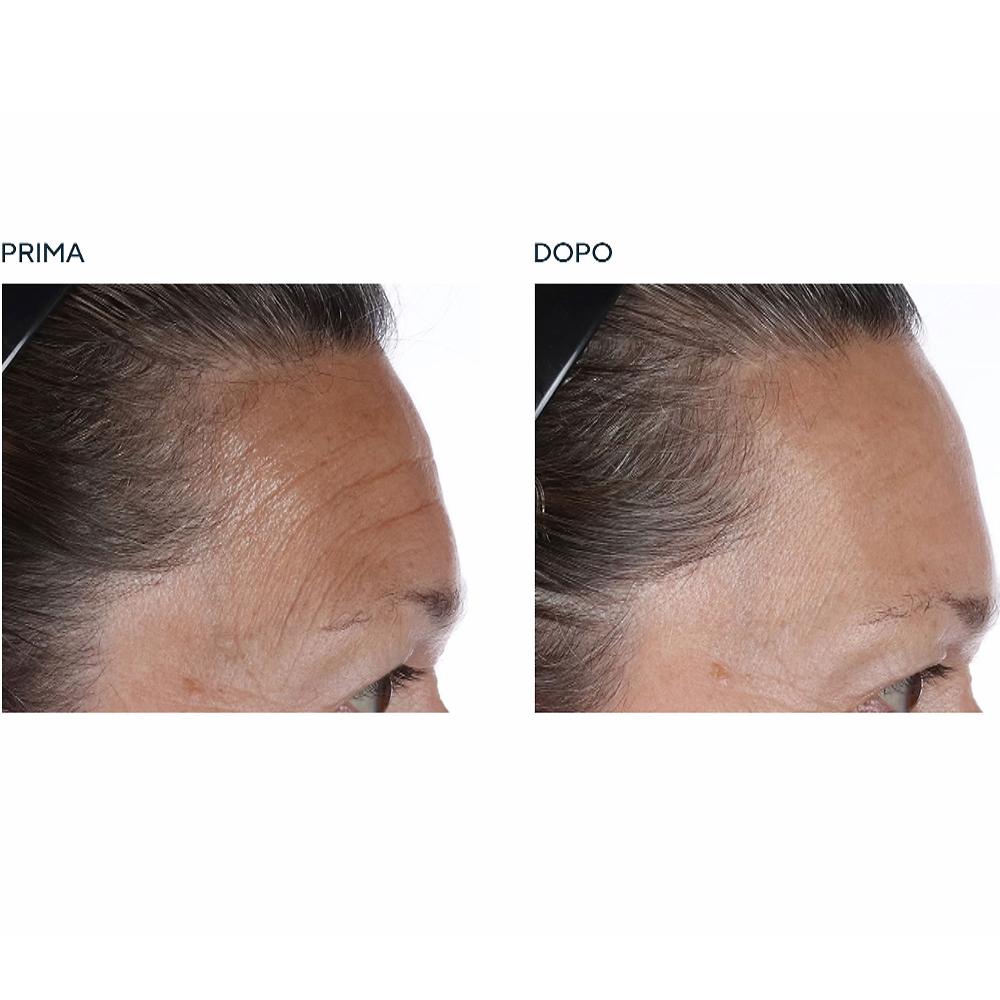 QVC Perricone MD 2 Olii Viso Essential Fx Acyl-Glutathione Chia