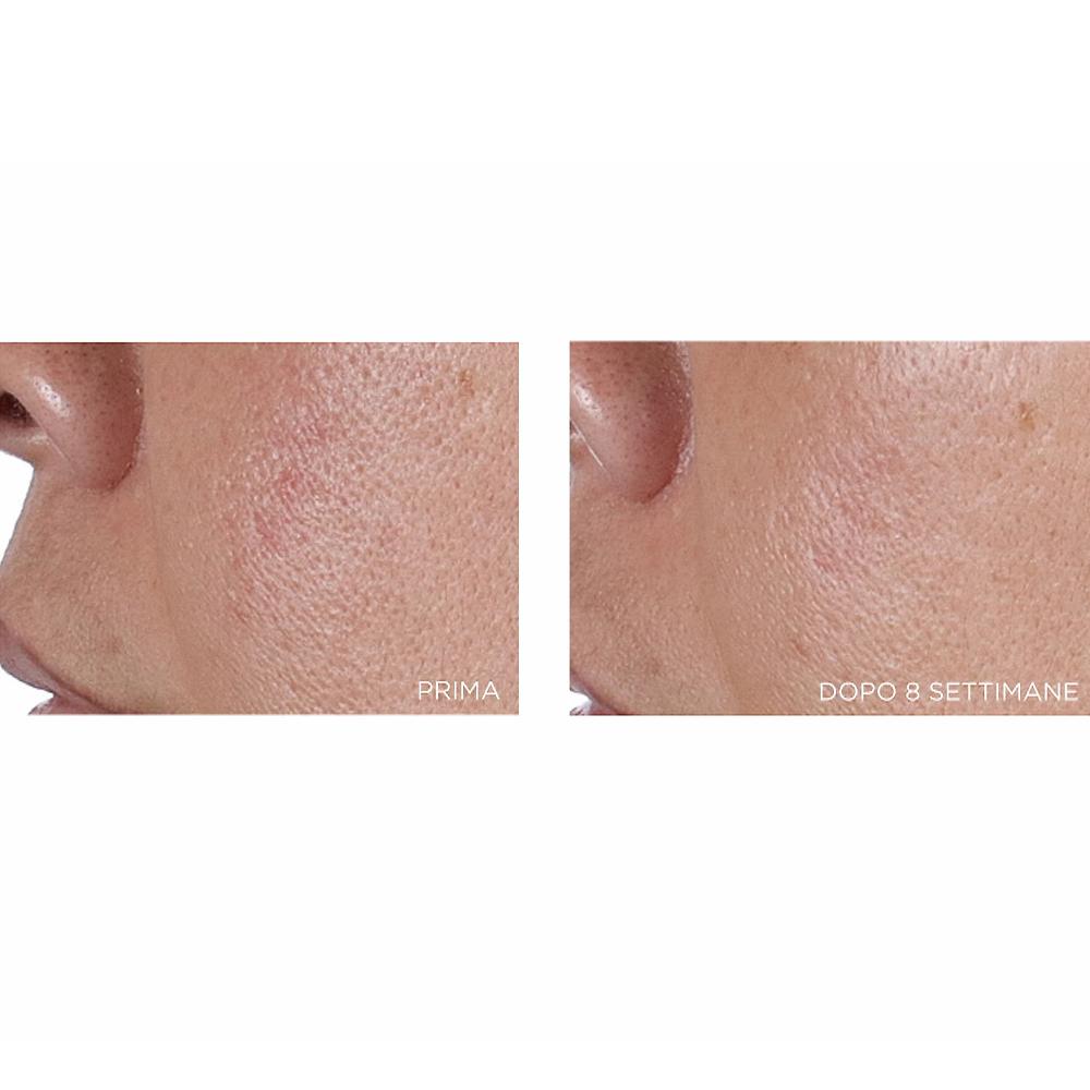 QVC Perricone MD 2 Tonici Viso Linea High Potency Finishing & Firming