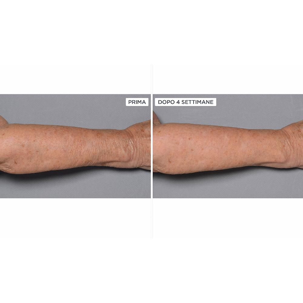 QVC Perricone MD Cold Plasma+Fragile Skin Corpo 2pz