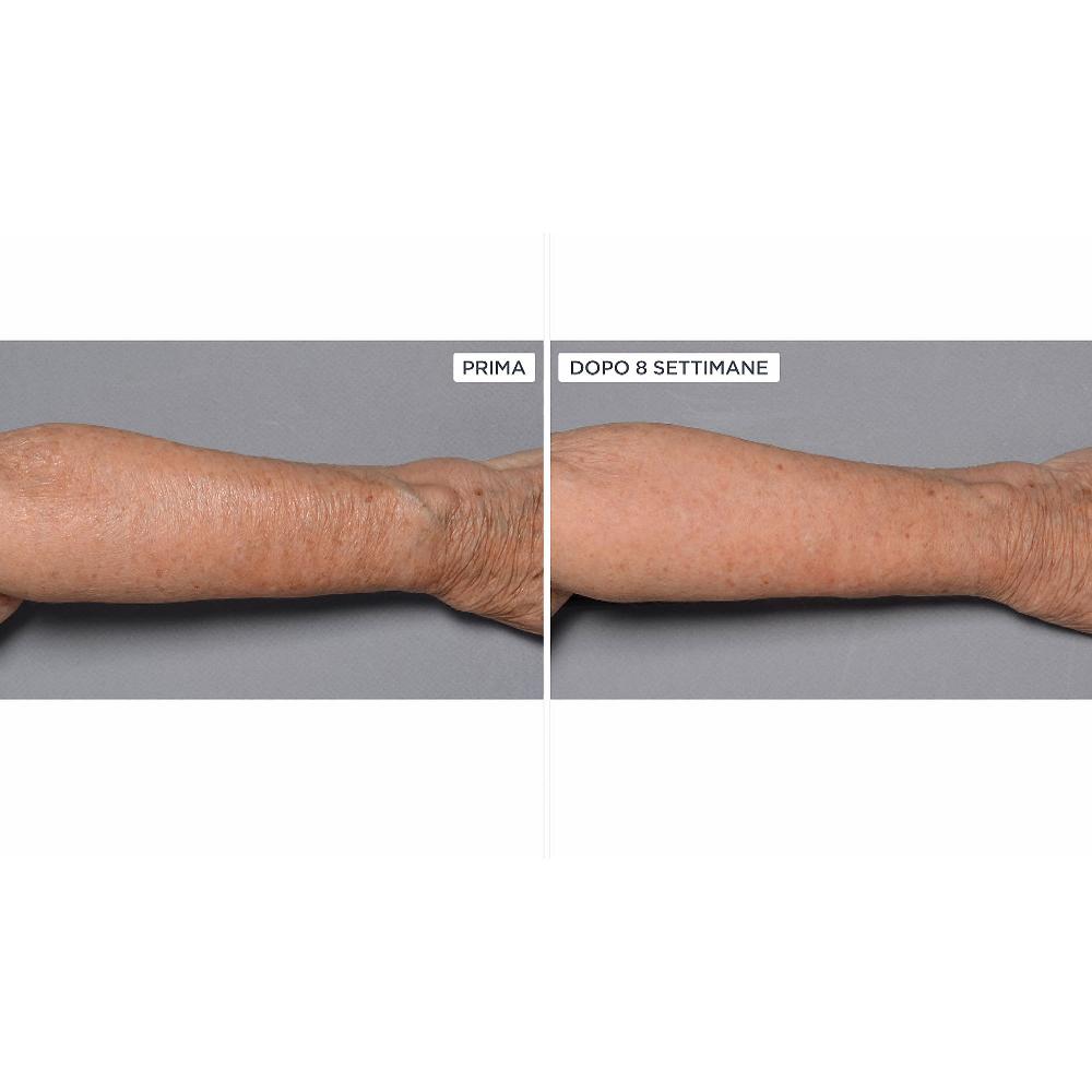 QVC Perricone MD Cold Plasma+Fragile Skin Corpo 2pz