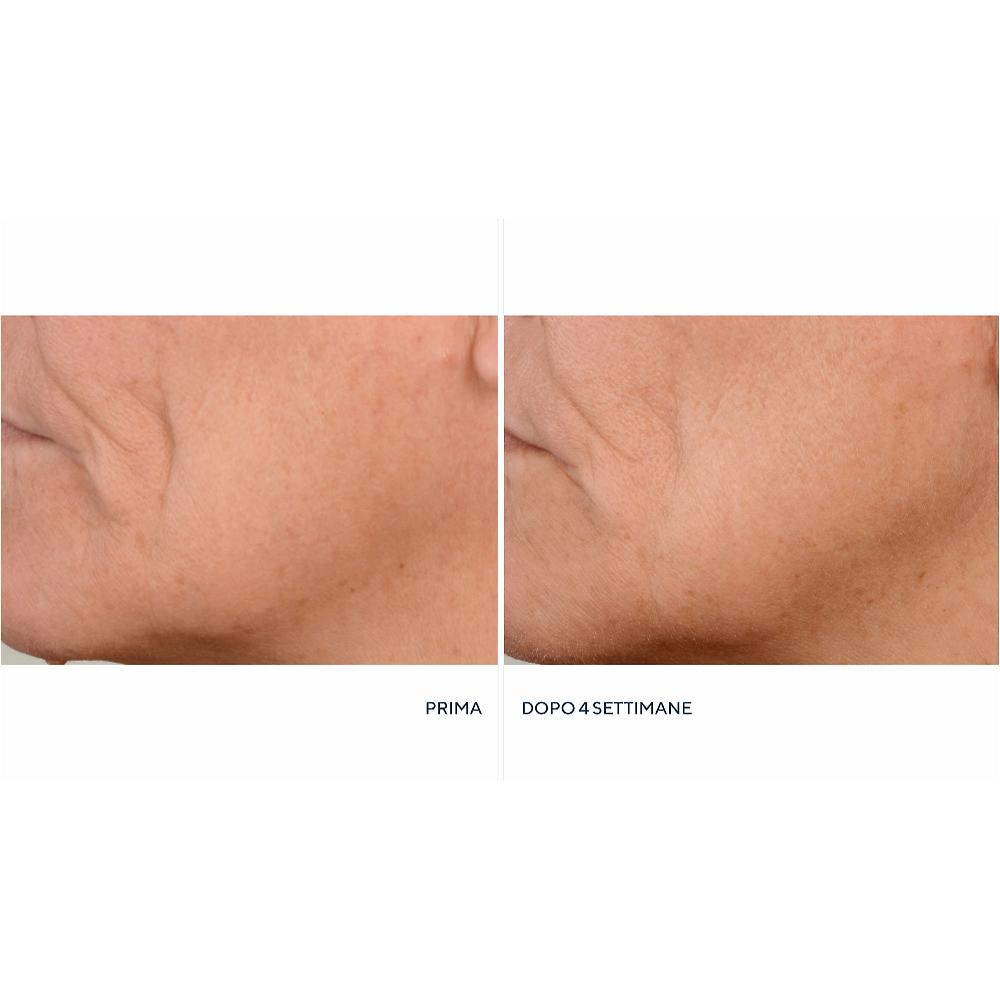 QVC Perricone MD Crema Notte Essential FX + Siero Firming&Lifting