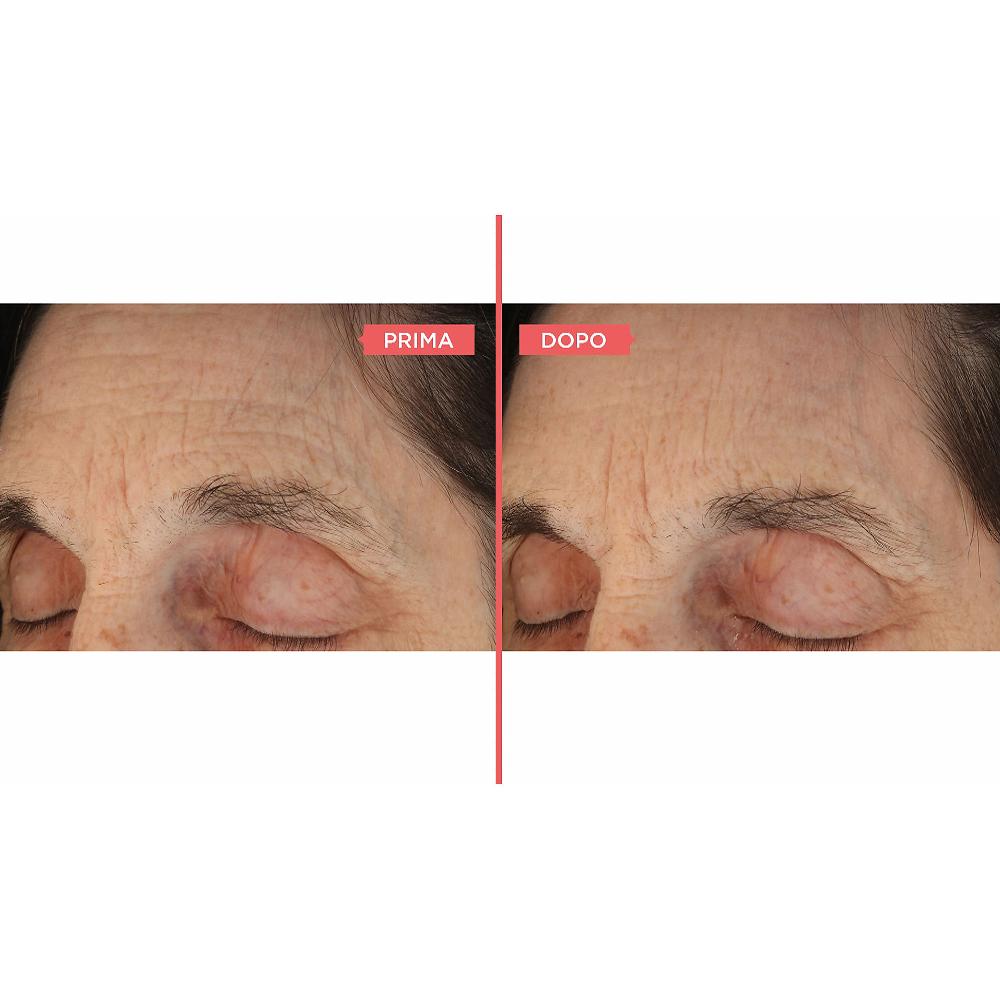 QVC Perricone MD Essential Deep Crease Sieri Per Viso 2pz