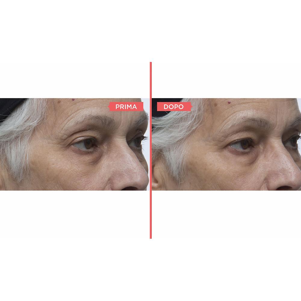 QVC Perricone MD Eyelid Serum Duo Siero Occhi Antiossidante