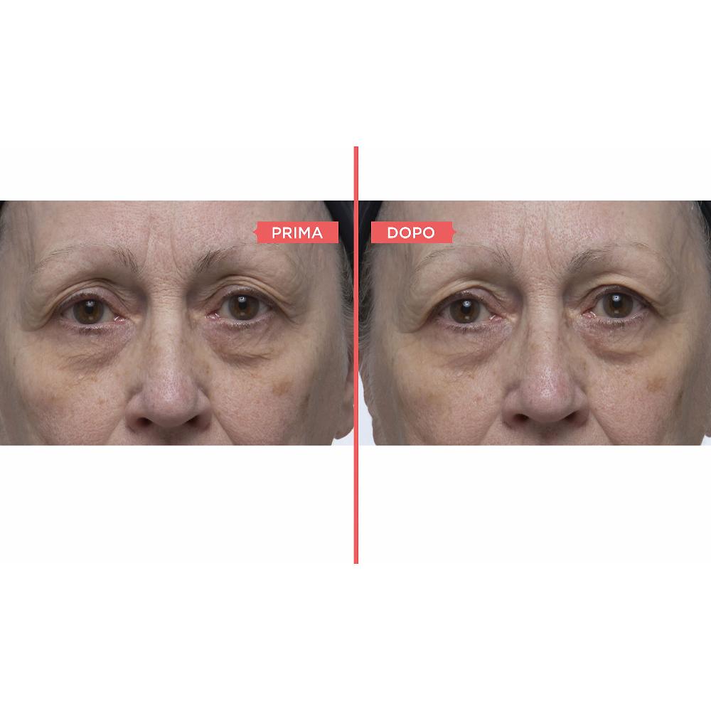 QVC Perricone MD Eyelid Serum Duo Siero Occhi Antiossidante