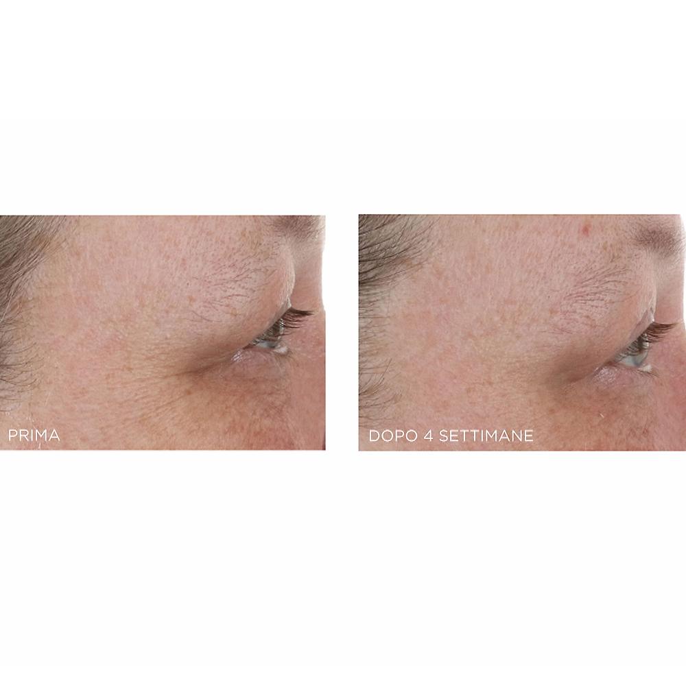 QVC Perricone MD Hight Potency 2 Creme Idratanti Notte Con Retinolo