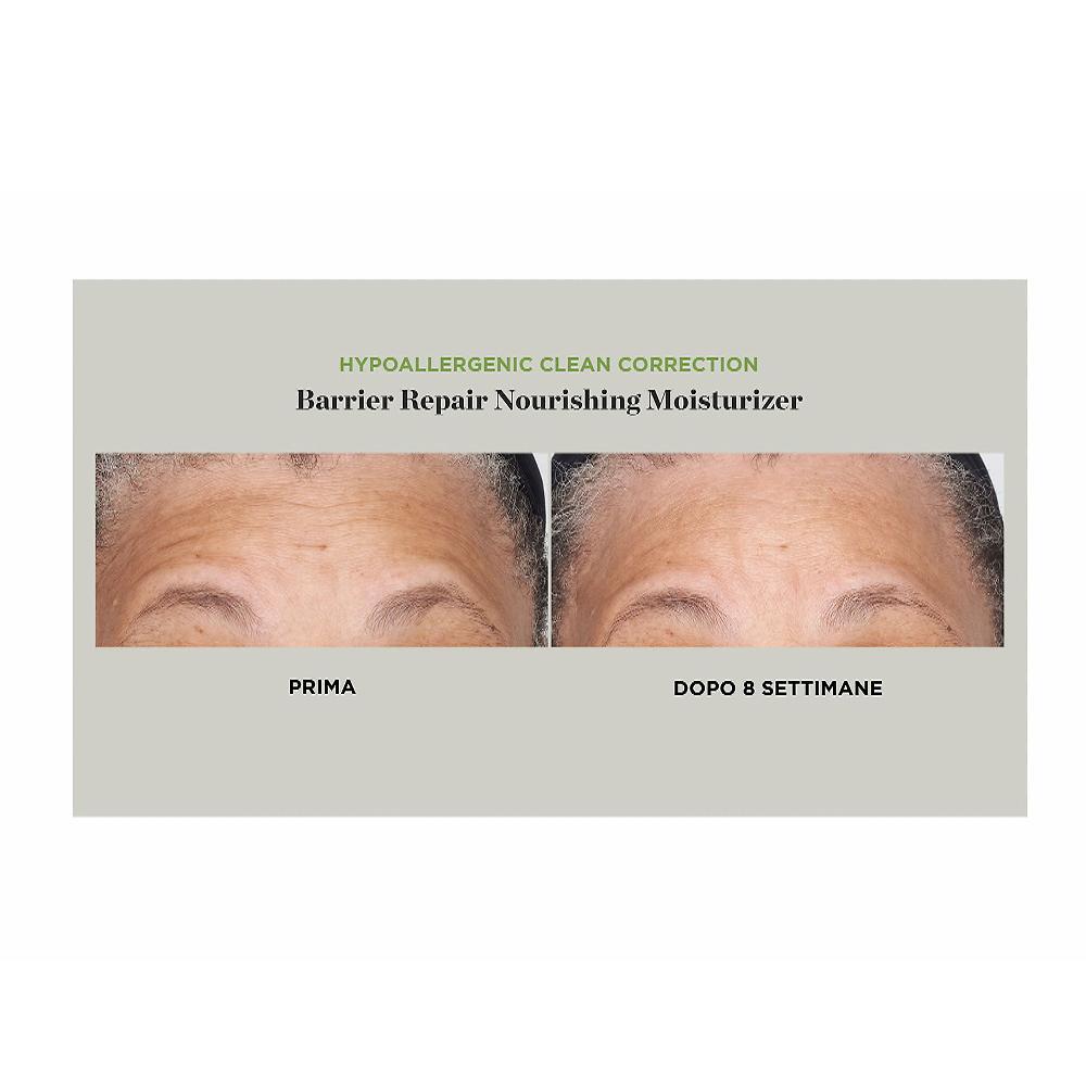 QVC Perricone MD Hypoallergenic E Cold Plasma+ Kit Viso Occhi Labbra