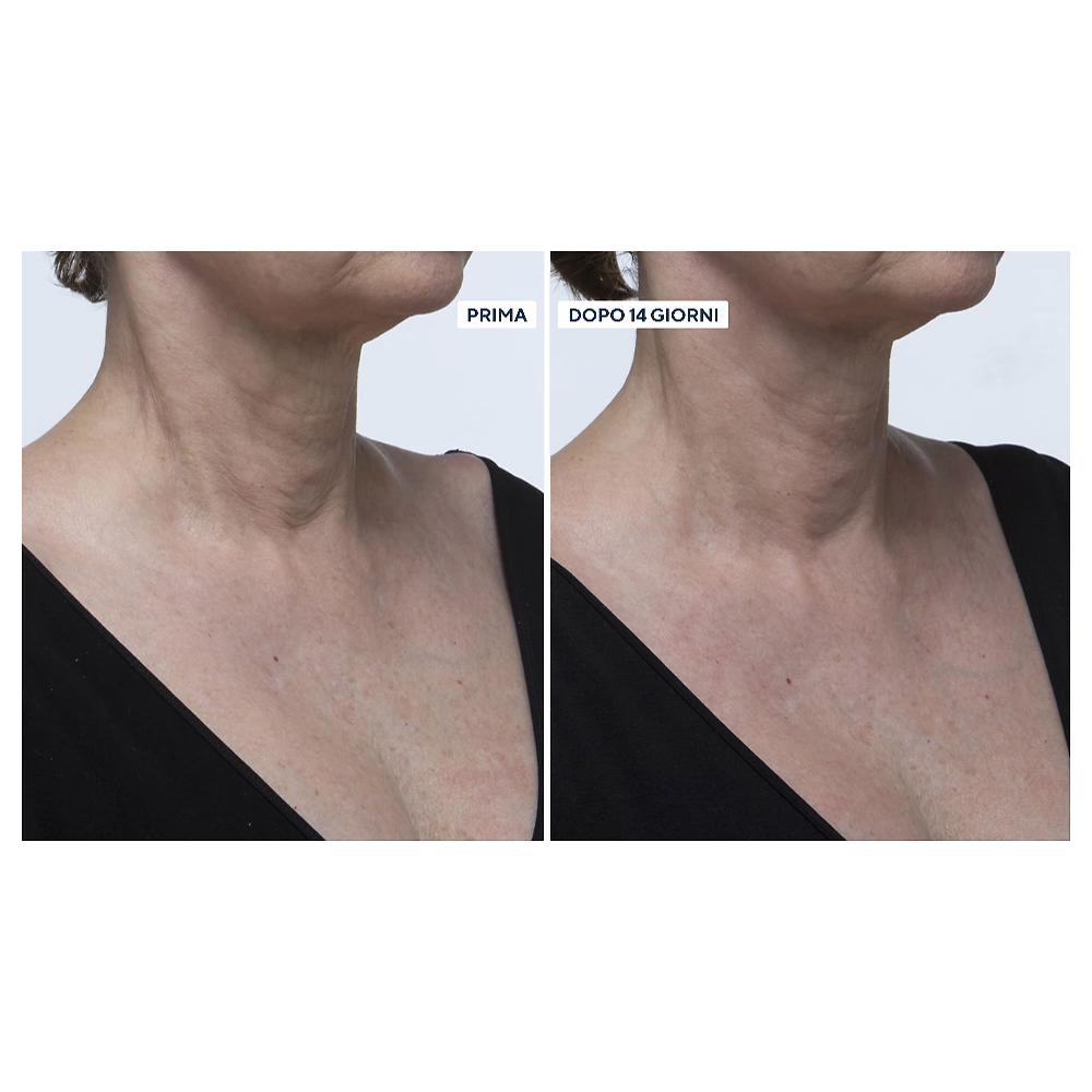 QVC Perricone MD Kit 2 Creme Neuropeptide Collo E Décolleté