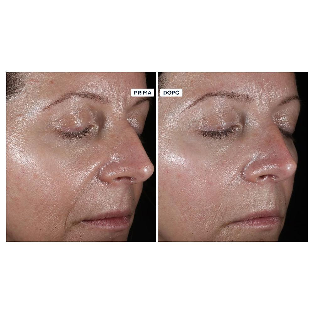 QVC Perricone MD Kit 4 Prodotti Viso: Detergente Idratante Siero Viso E Occhi