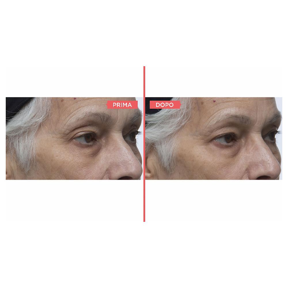 QVC Perricone MD Kit 4 Prodotti Viso: Detergente Idratante Siero Viso E Occhi