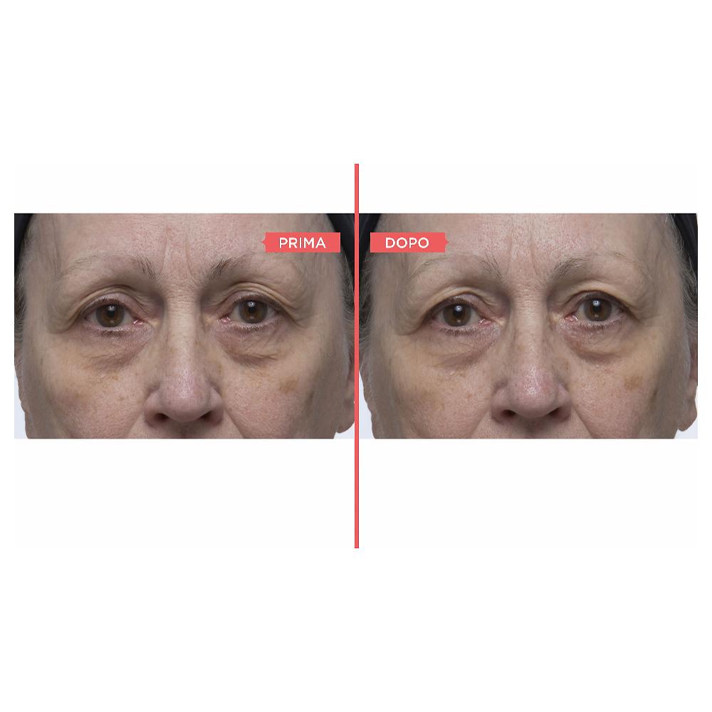 QVC Perricone MD Kit 4 Prodotti Viso: Detergente Idratante Siero Viso E Occhi