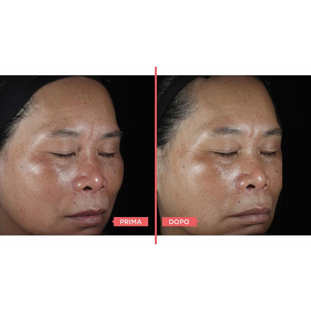 QVC Perricone MD No: Rinse Intensive Pore Minimizing Toner 2 X 118ml