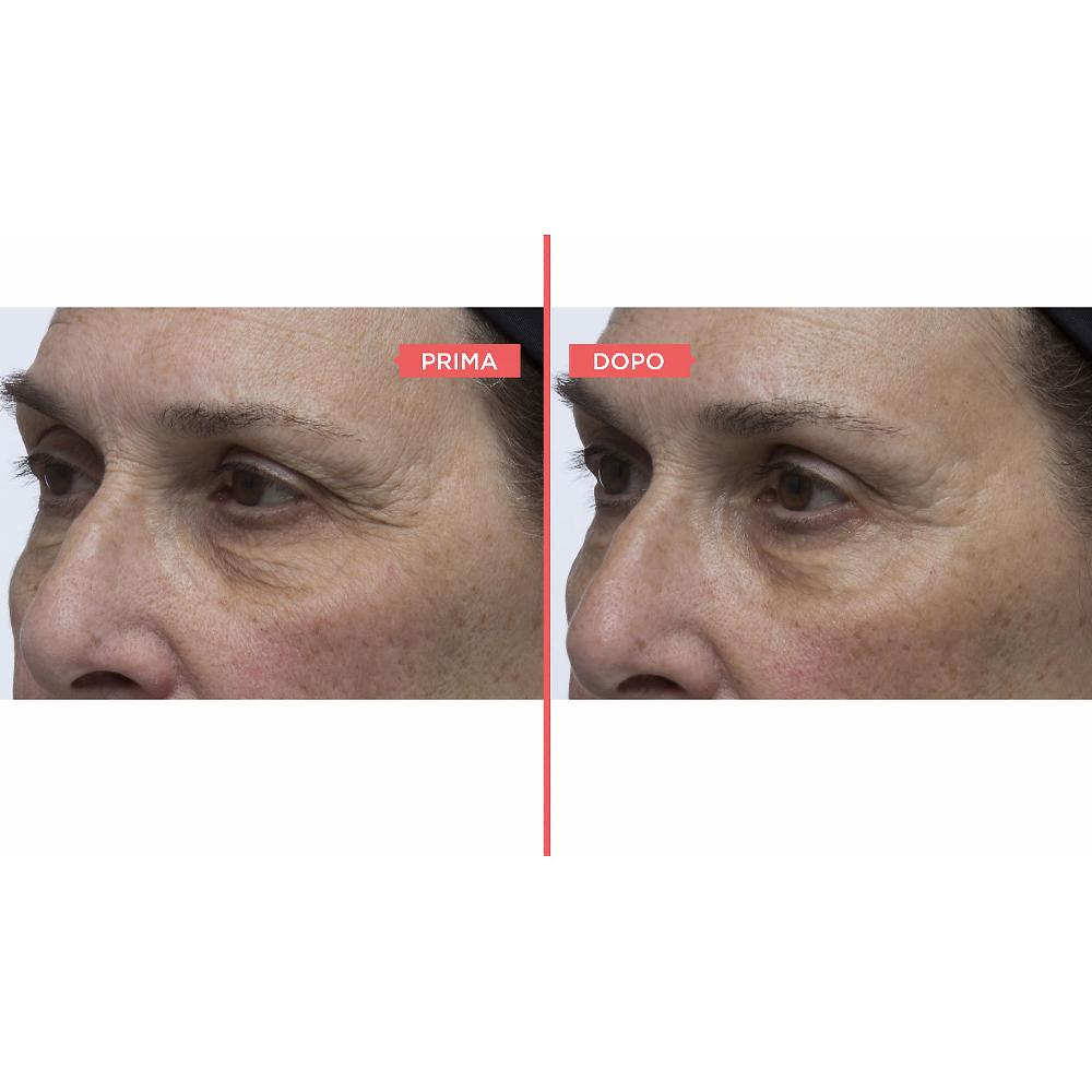 QVC Perricone MD Siero Occhi Essential FX E Mascara No Makeup