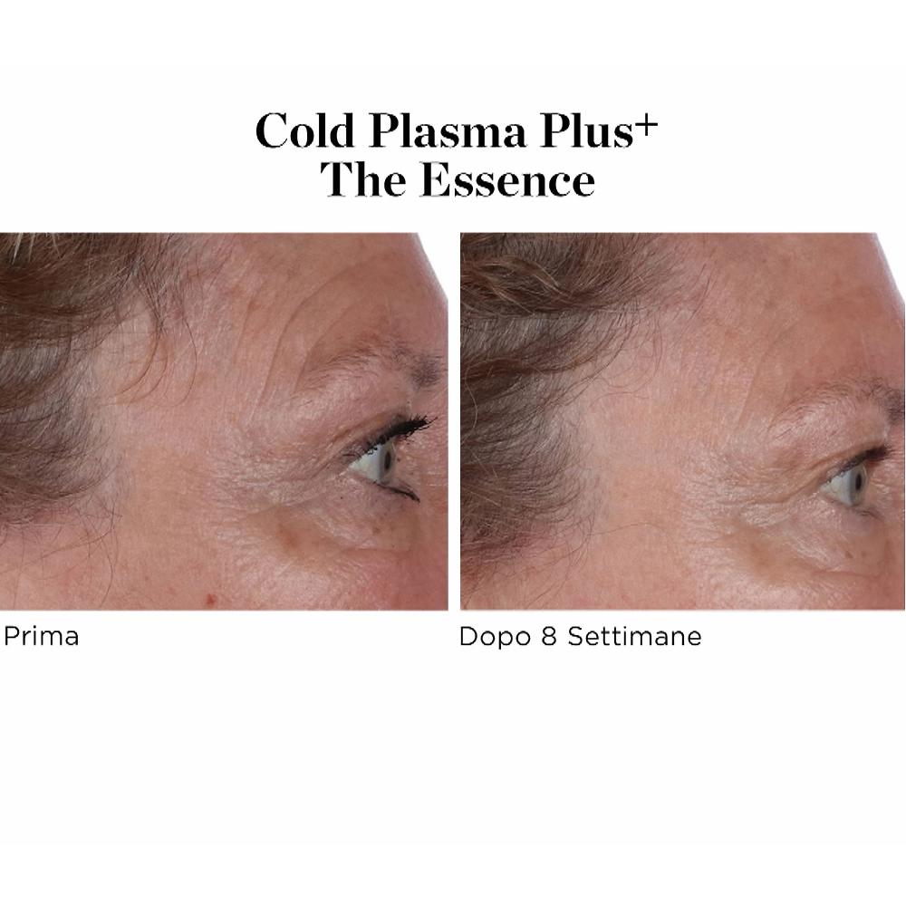 QVC Perricone MD Siero Viso Cold Plasma Plus+ The Essence