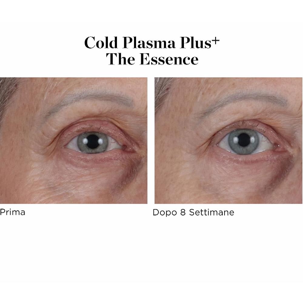 QVC Perricone MD Siero Viso Cold Plasma Plus+ The Essence