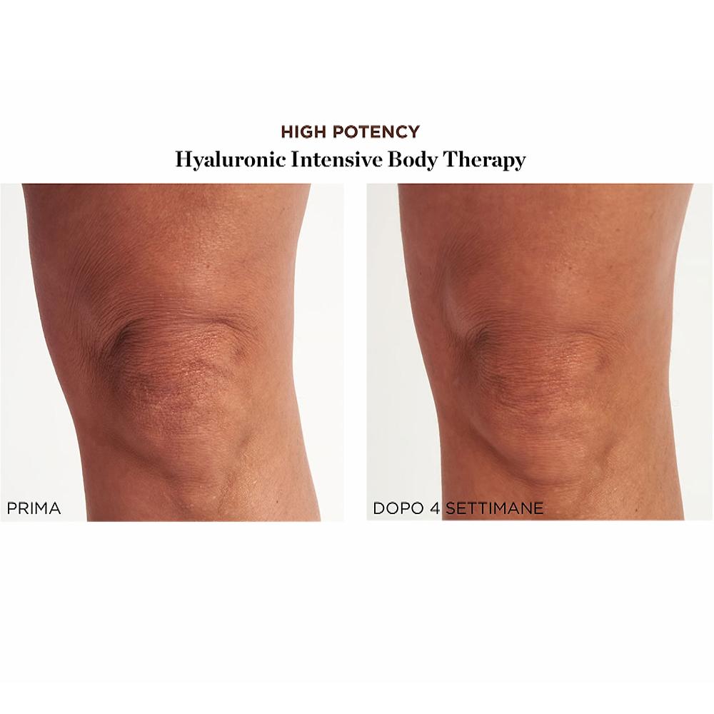 QVC Perricone MD Summer Hydrate&Glow Kit High Potency 4 Pezzi Viso E Corpo