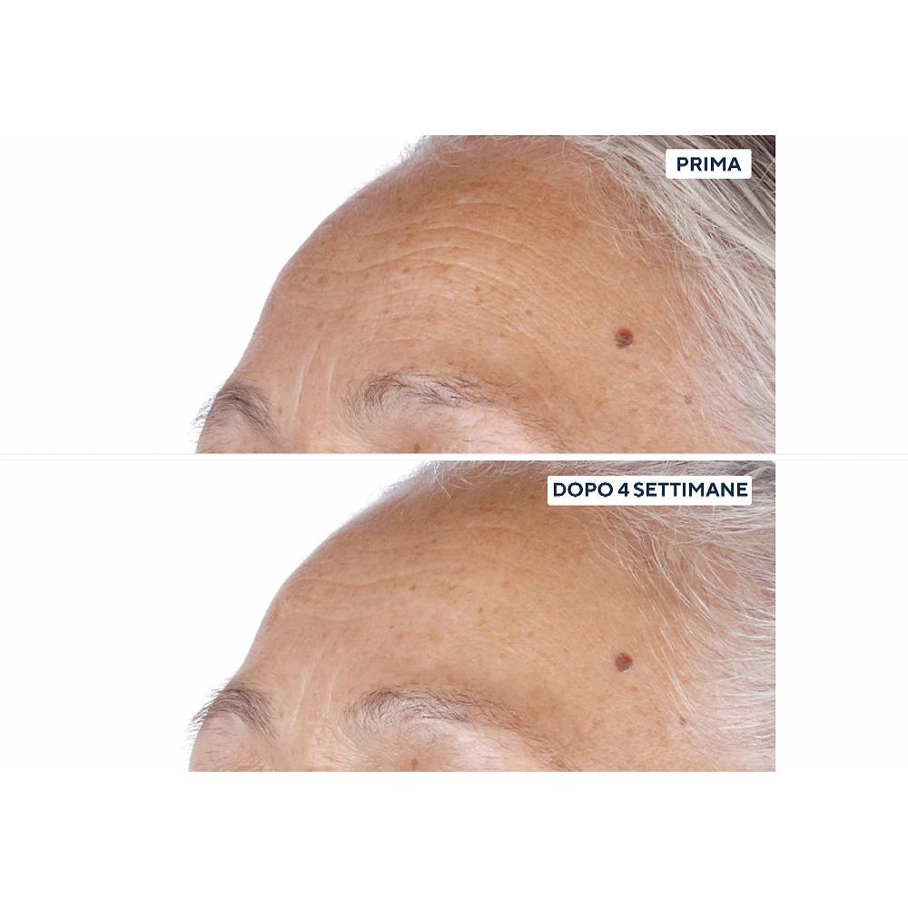 QVC Perricone MD Vitamin C Ester 2 Esfolianti Viso Polish & Peel