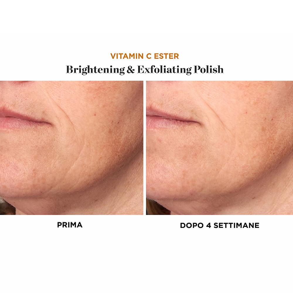 QVC Perricone MD Vitamin C Ester 2 Esfolianti Viso Polish & Peel