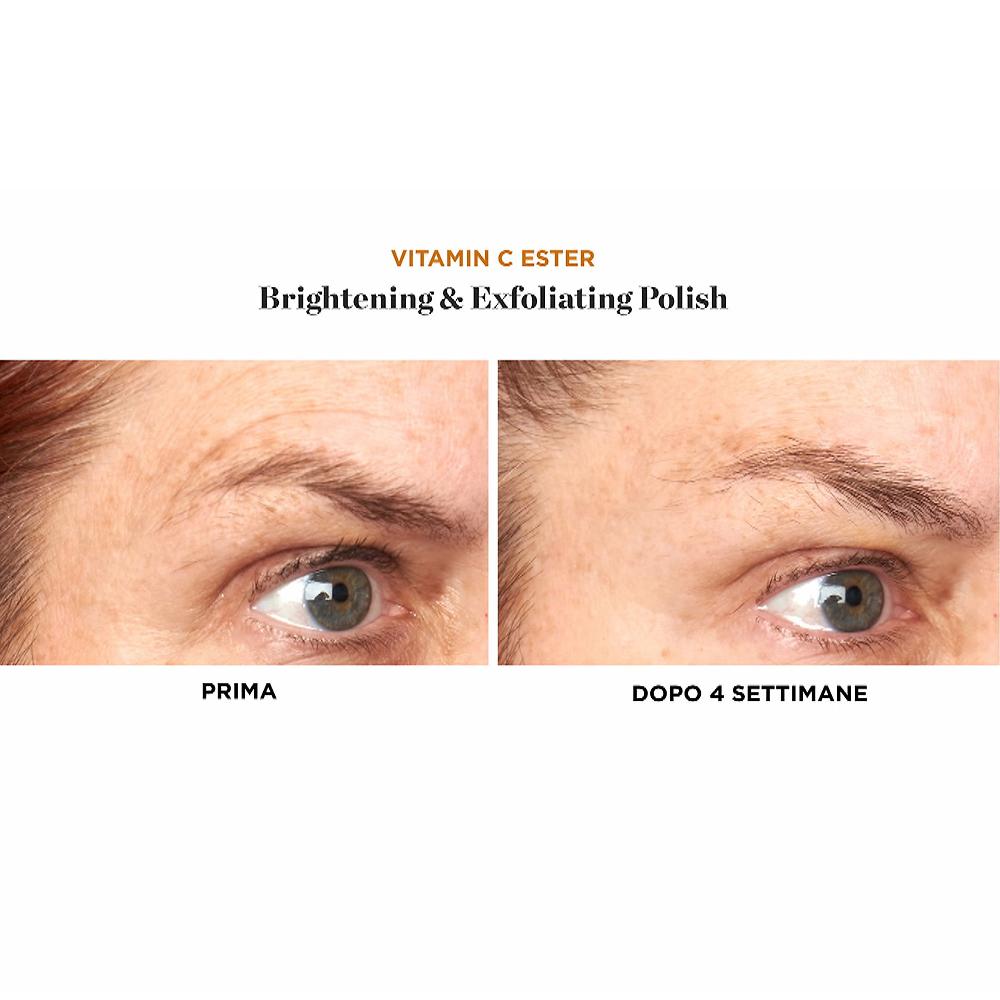 QVC Perricone MD Vitamin C Ester 2 Esfolianti Viso Polish & Peel