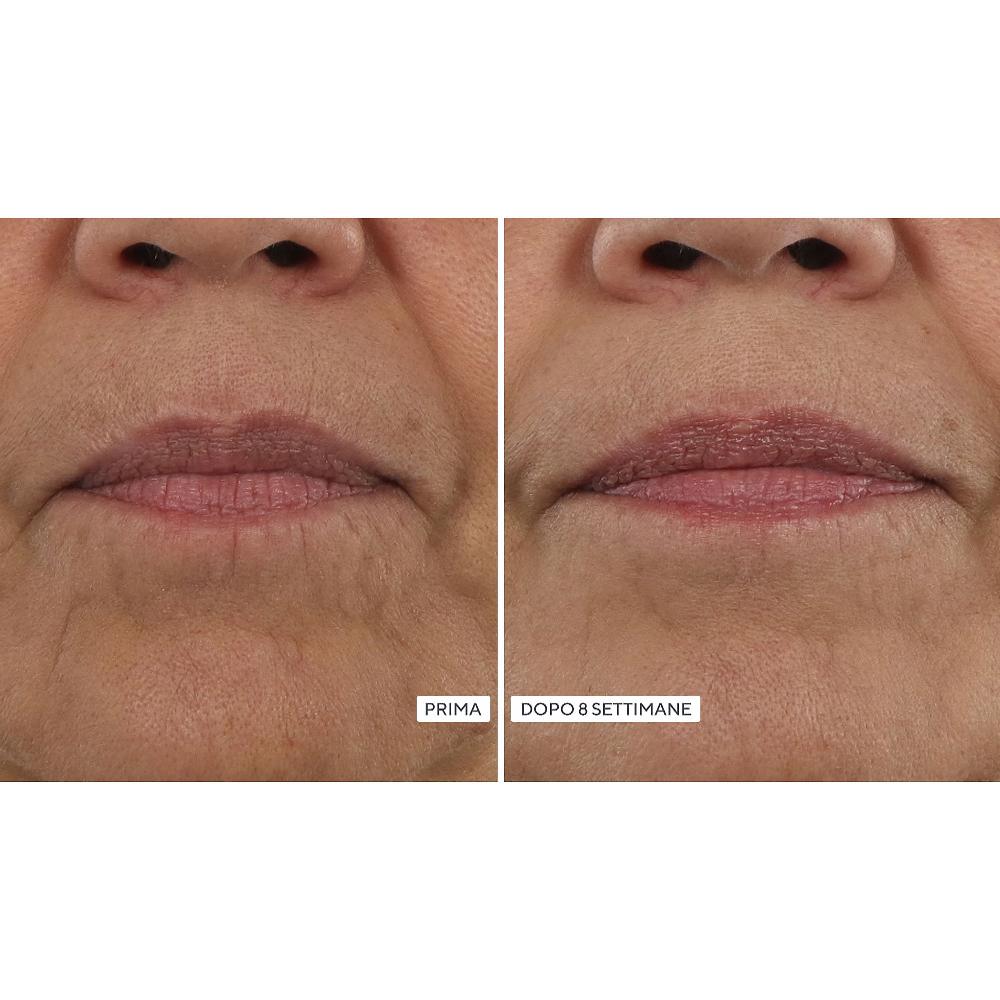 QVC Perricone MD Vitamin C Ester Kit: 4 Prodotti Viso Per Una Pelle Luminosa