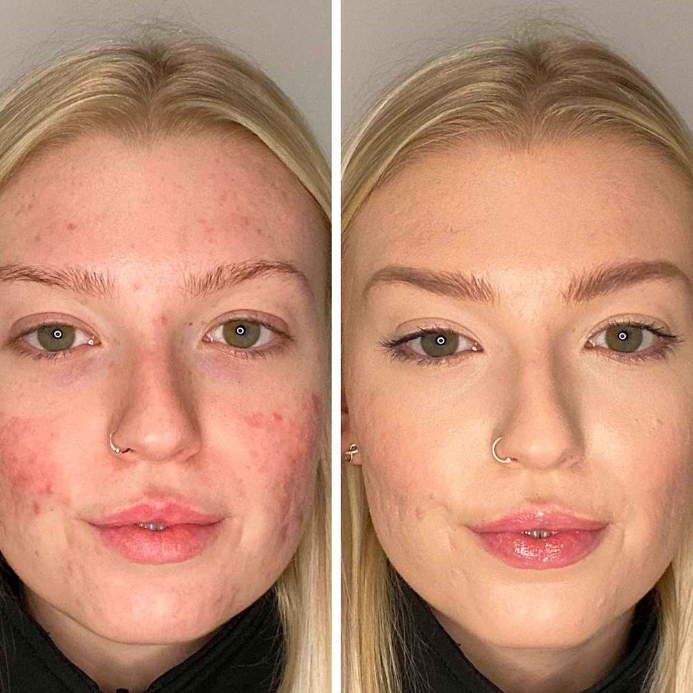 QVC Doll10 Fondotinta TCE Luminous Con Vitamina B3