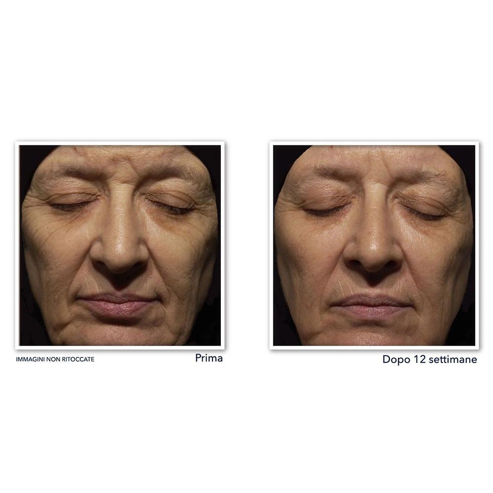 QVC RoC Retinol Correxion Crema Notte Retinolo