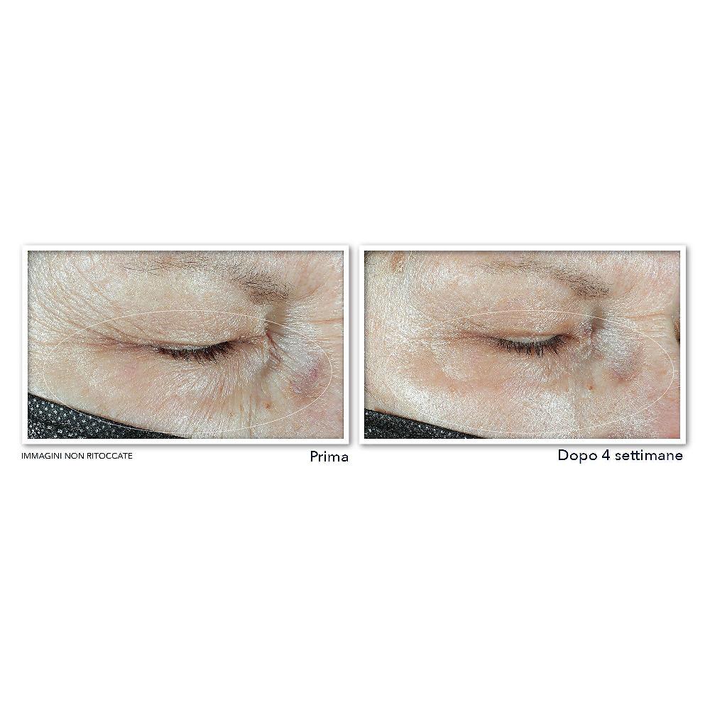 QVC RoC Contorno Occhi Multi Correxion Con Acido Ialuronico