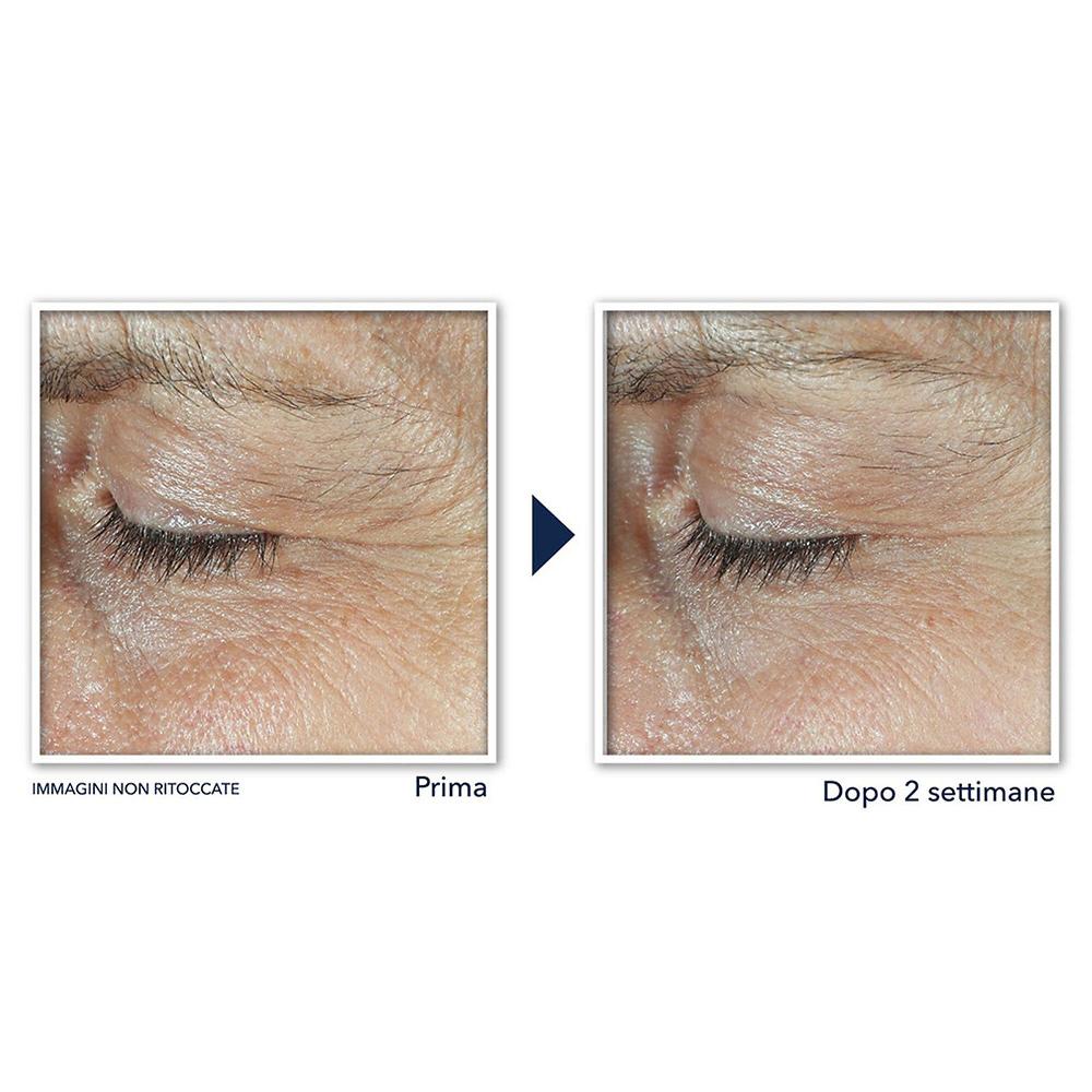 QVC RoC Crema Contorno Occhi Derm Correxion Con Retinolo