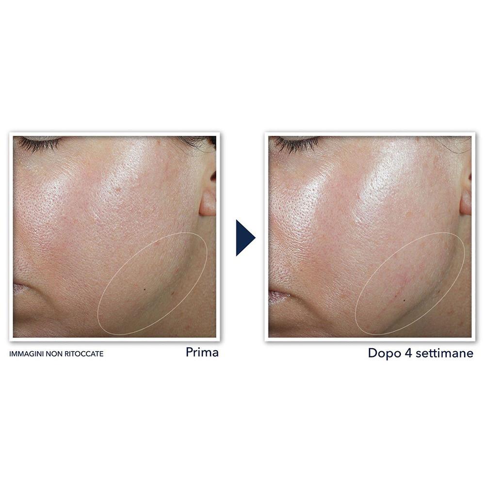 QVC RoC Crema Viso Derm Correxion® Ridefinisce E Rassoda