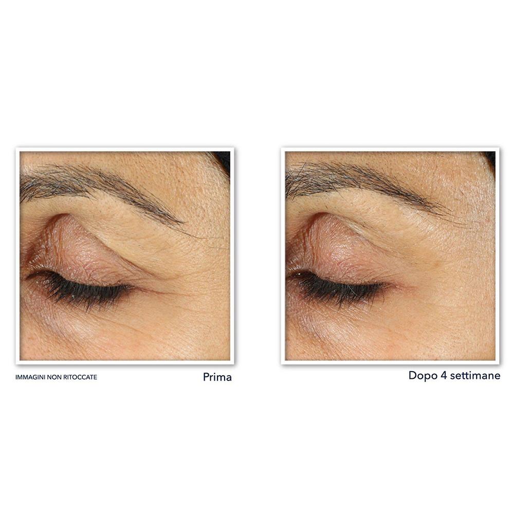 QVC RoC Retinol Correxion Line Smoothing Crema Contorno Occhi