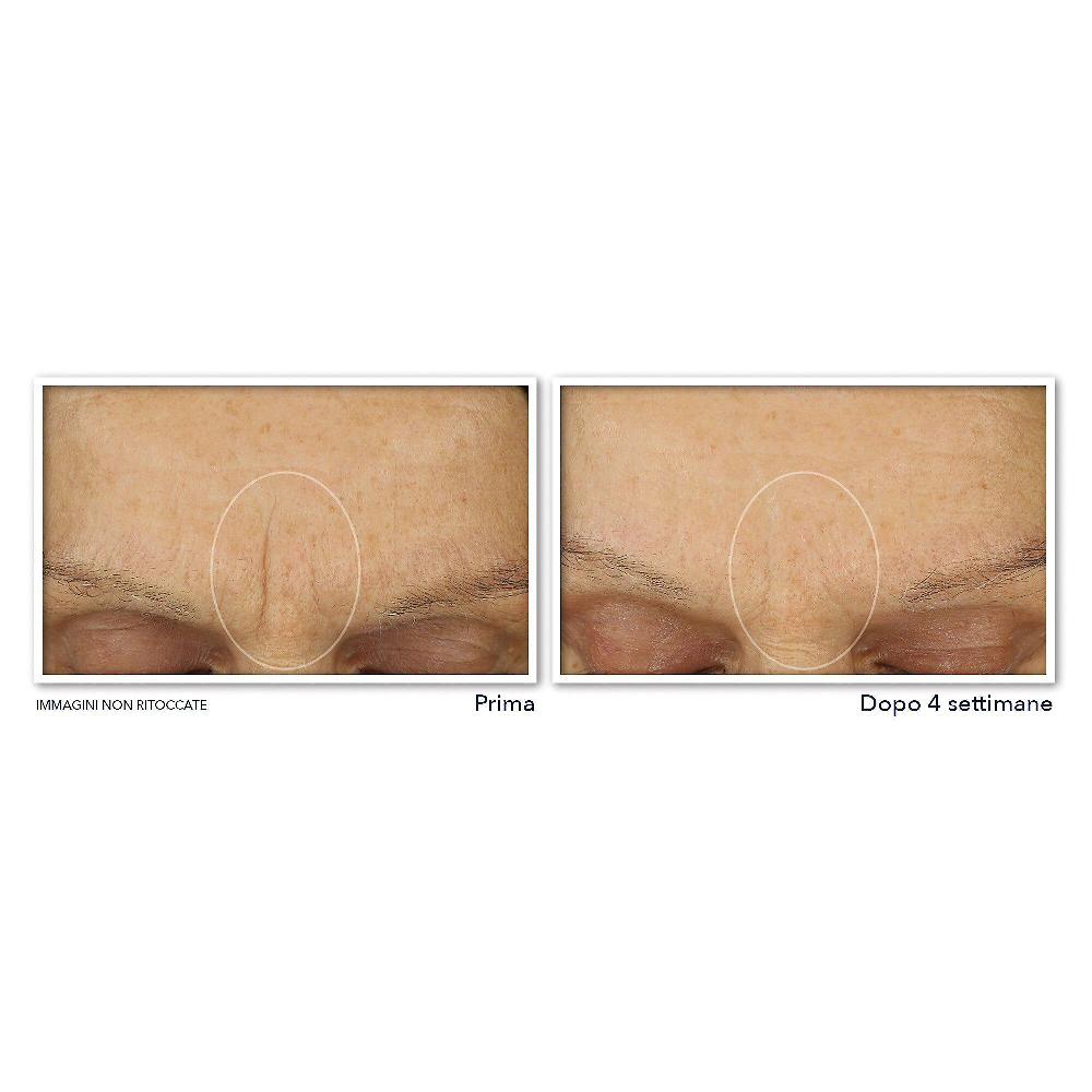 QVC RoC Retinol Correxion Line Smoothing Crema Viso Idratante