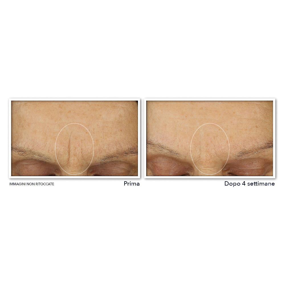 QVC RoC Retinol Correxion Line Smoothing Crema Viso Idratante