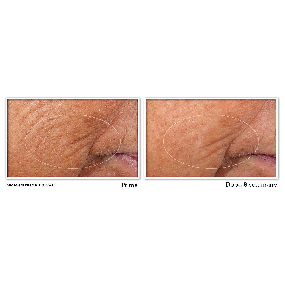 QVC RoC Retinol Correxion Line Smoothing Siero Notte