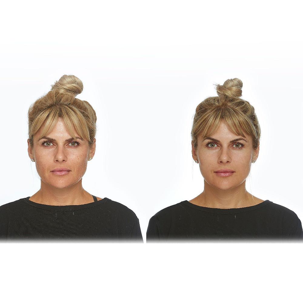 QVC Skinsense Maschera Viso Con Acido Ialuronico Hydranet